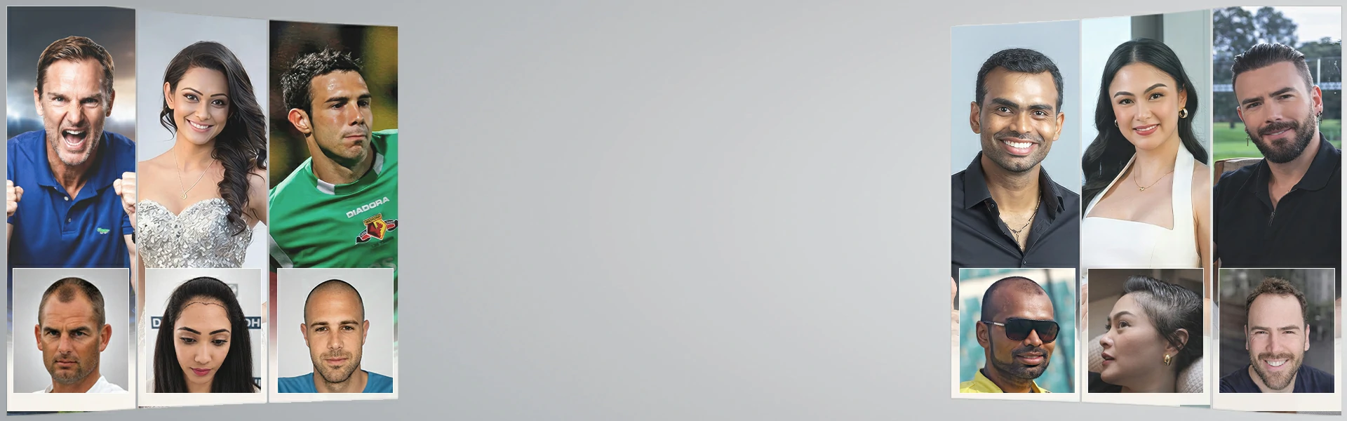 DHI Hair Restoration Banner
